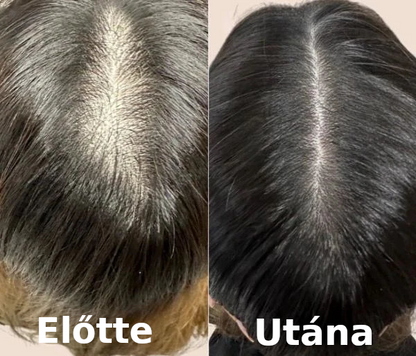 HajVital™ – Fejbőr és hajápoló masszírozó